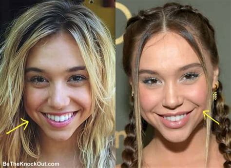 Alexis before plastic surgery/botox : r/TheUltimatumNetflix .